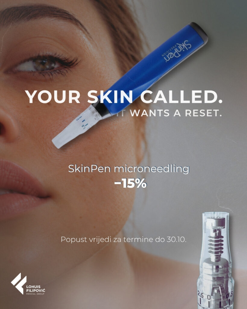 Popust 15% na SkinPen microneedling tretmane za lice